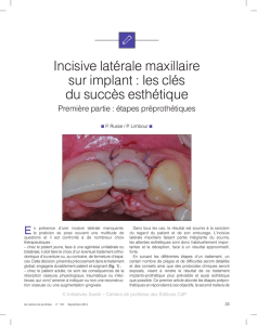 Incisive latérale maxillaire sur implant : les clés du succès esthétique