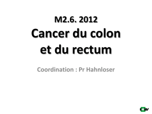 Cancer du colon et du rectum