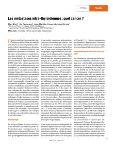Les métastases intra-thyroïdiennes : quel cancer ?