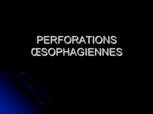 Perforations Œsophagiennes - Sapin - 14-09