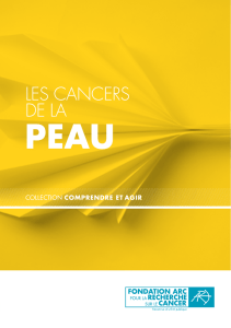 Brochure Cancers de la peau