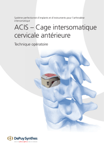 ACIS – Cage intersomatique cervicale antérieure Technique