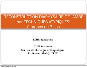 RECONSTRUCTION DIAPHYSAIRE DE JAMBE
