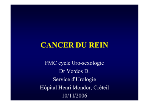 cancer du rein - Service d`Urologie