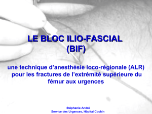 Le bloc ilio-fascial: une technique d`ALR pour les fractures de l
