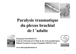 Paralysie traumatique du plexus brachial de l `adulte