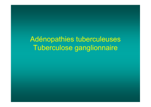 Adénopathies tuberculeuse - Soutien Pneumologique International
