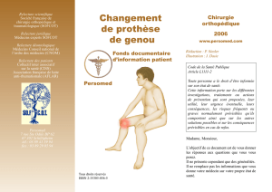 Changement PTG