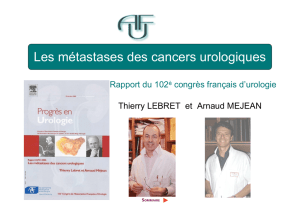 Les métastases des cancers urologiques
