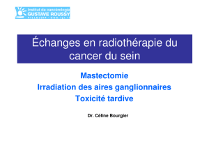 Échanges en radiothérapie du cancer du sein