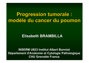 Progression tumorale du cancer du poumon - E. Brambilla