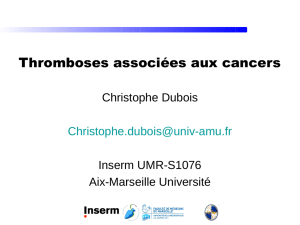 J WARE - Groupe Francophone thrombose et cancer