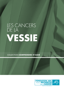 Les cancers de la vessie