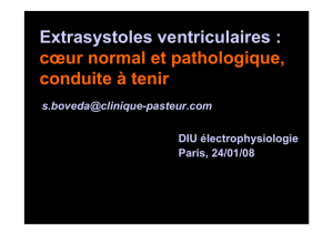Extrasystoles ventriculaires : cœur normal et pathologique, conduite