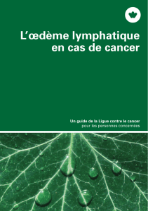 L`œdème lymphatique en cas de cancer