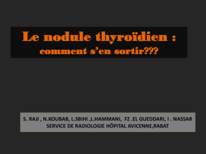 Le nodule thyroïdien : comment s`en sortir