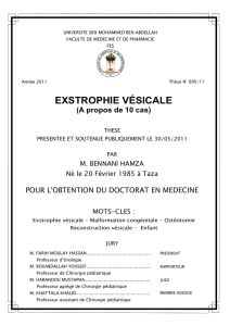 Exstrophie vesicale - Faculté de Médecine et de Pharmacie Fès