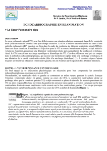 echocardiographie en reanimation - Faculté de Médecine Paris