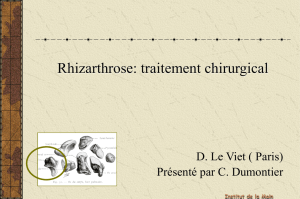 Rhizarthrose