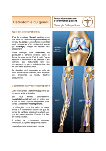 Ostéotomie du genou - Docteur Franck Hadjadje