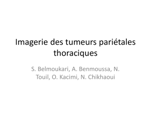 Imagerie des tumeurs pariétales thoraciques