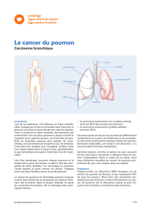 Le cancer du poumon
