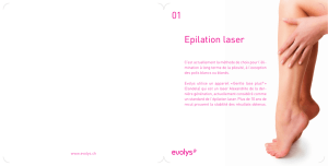 Epilation laser 01