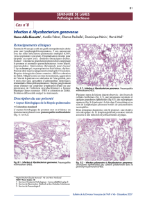 Infection à Mycobacterium genavense Cas n°8
