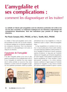 076-Dr Tewfik-amygdalite - STA HealthCare Communications