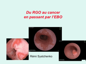 Du RGO au cancer en passant par l`EBO
