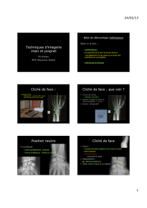 Imagerie du poignet et de la main - rhumatologie
