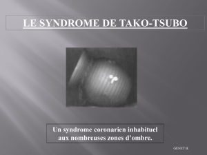Mise au point sur le syndrome de Tako Tsubo - chu