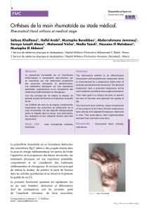 Orthèses de la main rhumatoïde au stade médical.
