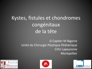 Kystes, Fistules et Chondromes - Captier - 10-03