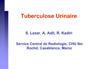 Tuberculose Urinaire - Société Française de radiologie