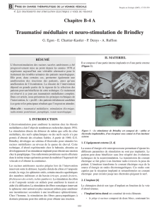 Traumatisé médullaire et neuro-stimulation de Brindley B
