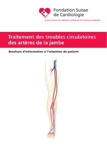 Traitement des troubles circulatoires des artères de la jambe