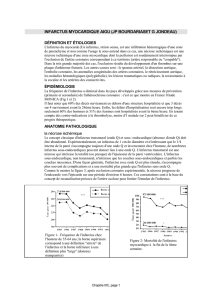 INFARCTUS MYOCARDIQUE AIGU (JP BOURDARIASET G