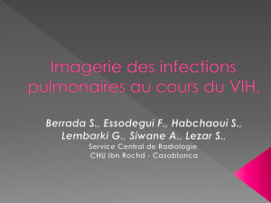 Imagerie des infections pulmonaires chez le patient HIV