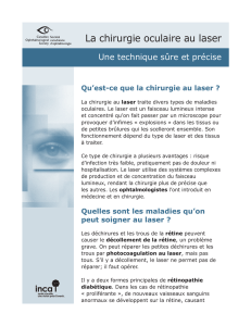 La chirurgie oculaire au laser, société canadienne d`ophtalmologie
