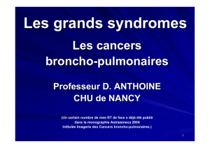 Les grands syndromes: Les cancers broncho-pulmonaires