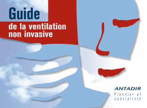 de la ventilation non invasive