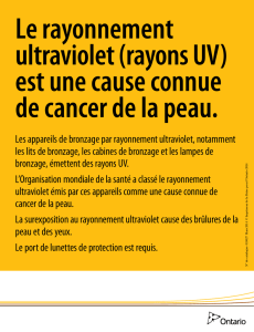 Le rayonnement ultraviolet (rayons UV) est une cause connue de