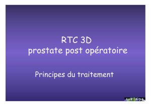 RTC 3D prostate post opératoire