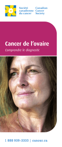 Cancer de l`ovaire : Comprendre le diagnostic