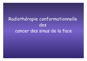 Radiothérapie conformationnelle des cancer des sinus de