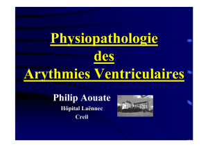 Physiopathologie des Arythmies Ventriculaires