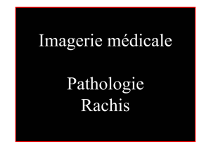 Pathologie du Rachis