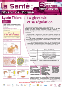 Le diabète de type 2