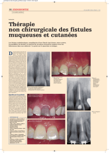 Thérapie non chirurgicale des fistules muqueuses et cutanées